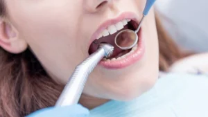 Read more about the article Dental Check-Ups in Howrah AC Market: Why Regular Visits Matter?