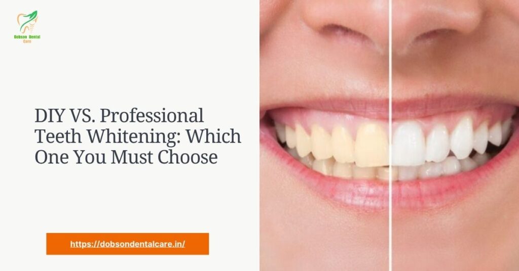 DIY VS. Professional Teeth Whitening: Which One You Must Choose
