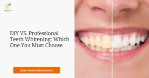 Read more about the article DIY VS. Professional Teeth Whitening: Which One You Must Choose