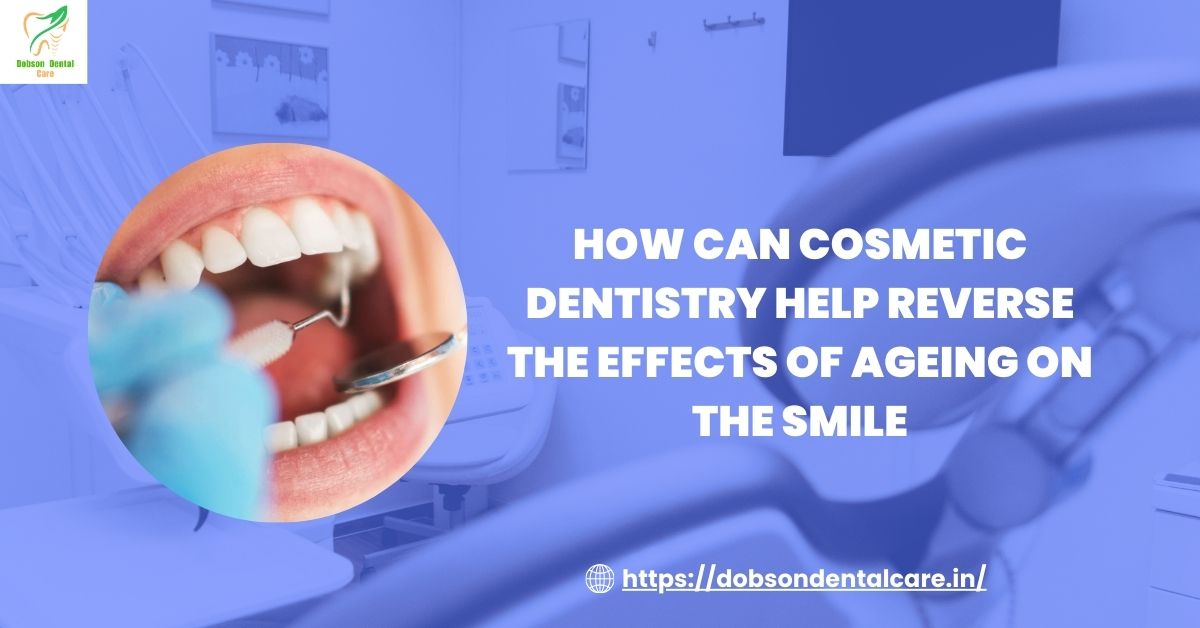 You are currently viewing How Can Cosmetic Dentistry Help Reverse the Effects of Ageing on the Smile