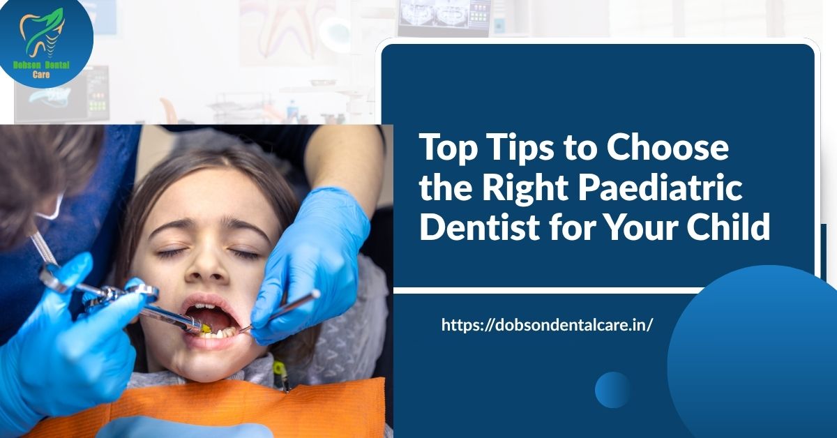You are currently viewing Top Tips to Choose the Right Paediatric Dentist for Your Child
